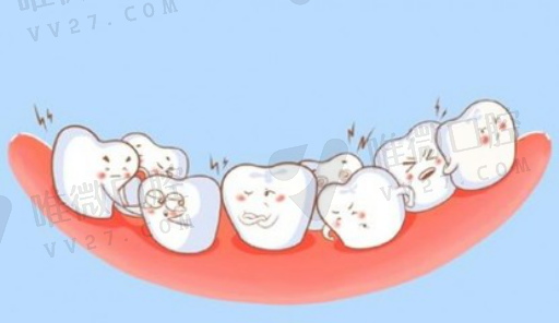 烤瓷美白牙齿的危害（烤瓷牙能美白吗）(图1)